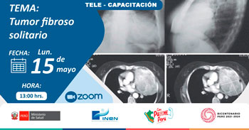 Capacitación online "Tumor fibroso solitario" del INEN