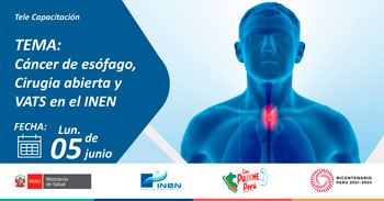 Capacitación online "Cáncer de esófago, cirugía abierta y VATS en el INEN" 
