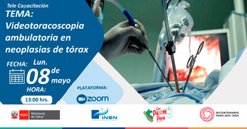 Capacitación online "Videotoracoscopia ambulatoria en neoplasias de tórax" del INEN