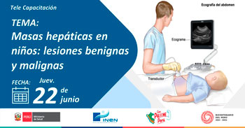 Capacitación online "Masas hepáticas en niños: lesiones benignas y malignas" del INEN