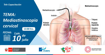 Capacitación online "Mediastinoscopia cervical" del INEN