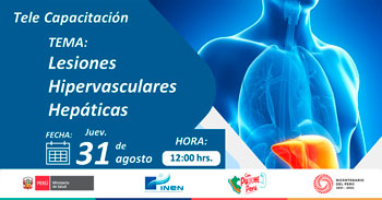 Capacitación online "Lesiones Hipervasculares Hepática" del INEN