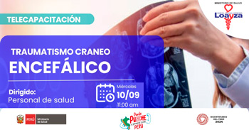  Capacitación online gratis "Traumatismo craneo encefálico" del Hospital Nacional Arzobispo Loayza