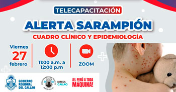  Capacitación online "Alerta sarampión, cuadro clínico y alerta epidemiológica" de la Diresa Callao