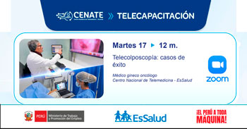  Capacitación online "Telecolposcopía: casos de éxito" del EsSalud