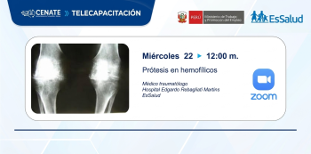 Capacitación virtual - "Prótesis en hemofílicos" EsSalud