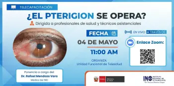  Capacitación online- "¿El pterigión se opera?" INO Oftalmología