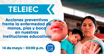  Charla online - "Acciones preventivas frente a la enfermedad de manos, pies y boca" Diresa Lima