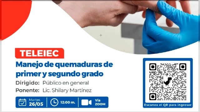  Charla virtual - "Manejo de quemaduras de primer y segundo grado" Hospital de rehabilitación del Callao