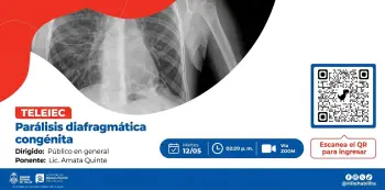  Charla virtual - "Parálisis diafragmática congénita" Hospital de rehabilitación del Callao