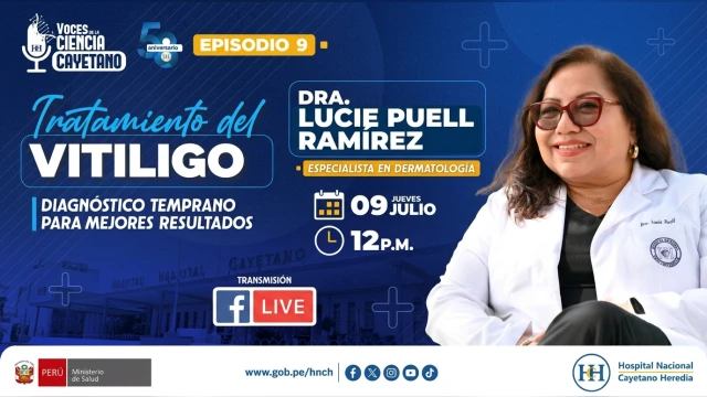 Conferencia online gratis - "Tratamiento del vitiligo: Diagnóstico temprano para mejores resultados" MINSA